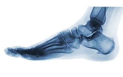 Foot and Ankle Surgery